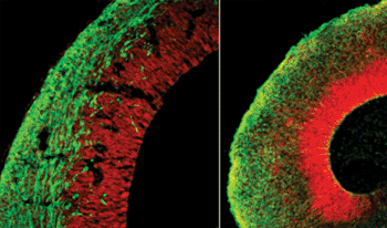 Image: Comparison of the organoid (right) to the developing brain (left, section of a mouse brain) (Photo courtesy of the Institute of Molecular Biotechnology of the Austrian Academy of Sciences).